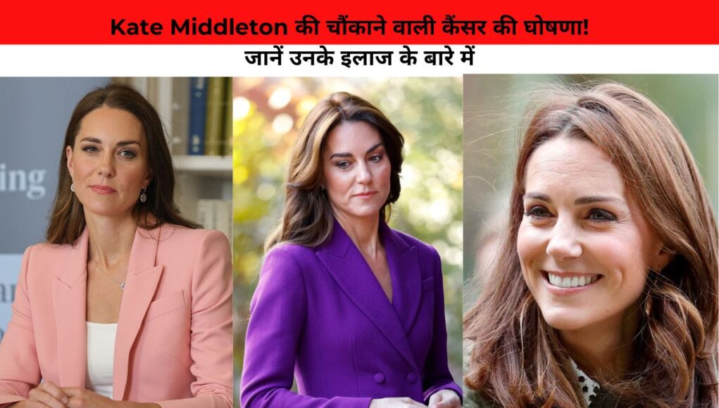 Kate Middleton की चौंकाने वाली कैंसर की घोषणा! जानें उनके इलाज के बारे में