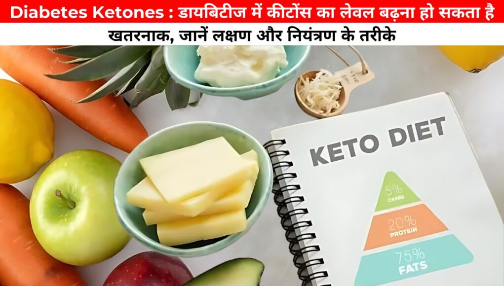 Diabetes Ketones : डायबिटीज में कीटोंस का लेवल बढ़ना हो सकता है खतरनाक, जानें लक्षण और नियंत्रण के तरीके